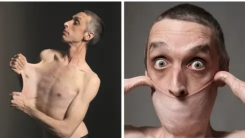 پوست