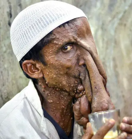 سصس