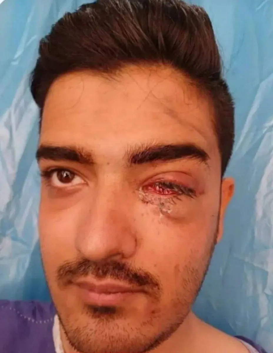 هوادار پرسپولیس