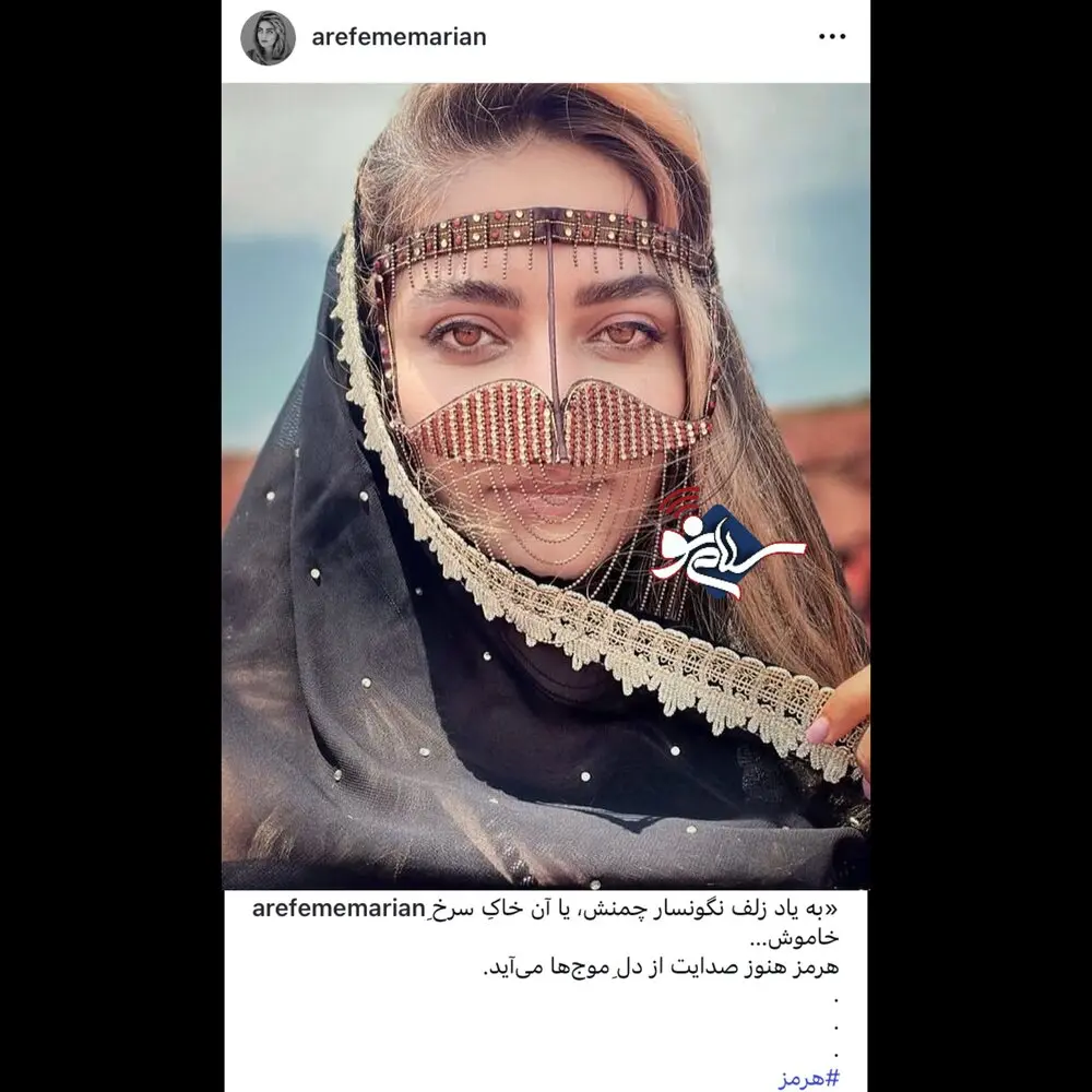 15810521