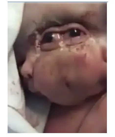 سه چشم