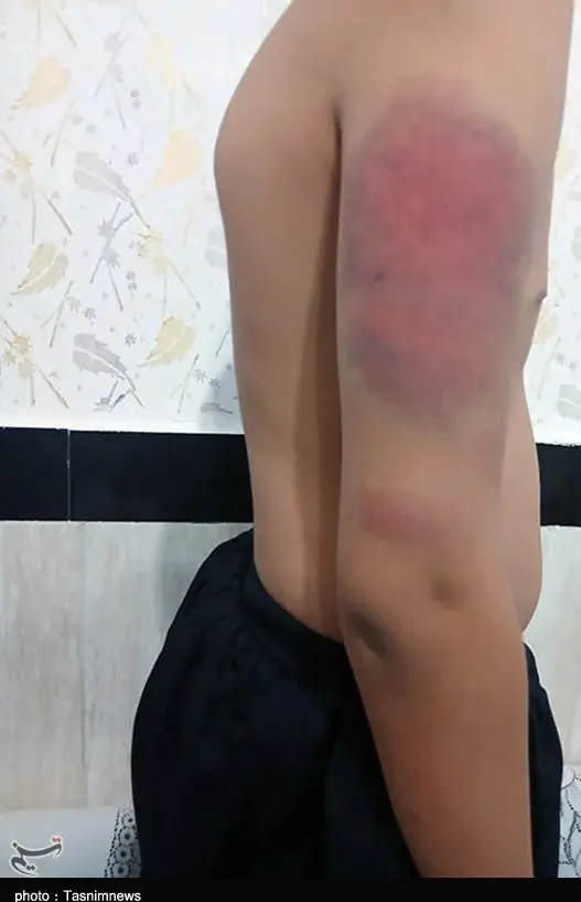 تنبیه5