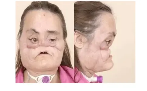 پیوند2