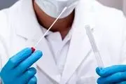 جدیدترین مدل آزمایش سریع و کم هزینه کرونا