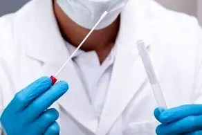جدیدترین مدل آزمایش سریع و کم هزینه کرونا
