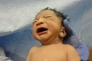 تولد نوزادی عجیب الخلقه با دم دراز و عجیب/ عکس