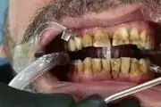 نقشه کثیف دندانپزشک بی‌آبرو برای بیمارانش