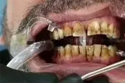 نقشه کثیف دندانپزشک بی‌آبرو برای بیمارانش