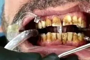 نقشه کثیف دندانپزشک بی‌آبرو برای بیمارانش
