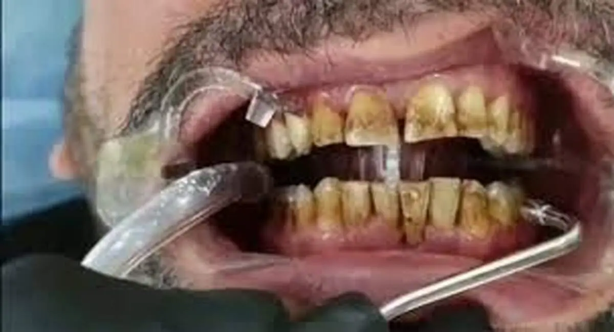 نقشه کثیف دندانپزشک بی‌آبرو برای بیمارانش