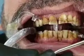 نقشه کثیف دندانپزشک بی‌آبرو برای بیمارانش