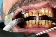 نقشه کثیف دندانپزشک بی‌آبرو برای بیمارانش