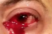 گریه خونین مرد بیچاره در بیمارستان!+ عکس