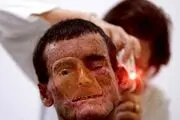 ذوب شدن ناگهانی صورت اهالی این روستا/ عکس+18