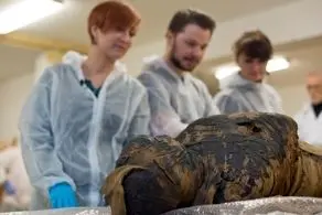 لحظه حال بهم زن خارج کردن جنین ۳۵ ساله مومیایی از رحم یک زن!/ فیلم