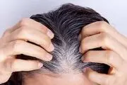 کمبود این ویتامین باعث سفید شدن مو می‌شود!