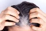 کمبود این ویتامین باعث سفید شدن مو می‌شود!