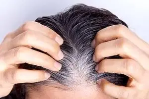 کمبود این ویتامین باعث سفید شدن مو می‌شود!