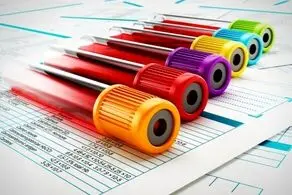 چگونه برگه آزمایش را خودتان بخوانید؟ +جدول