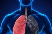 خوردن این دو ماده غذایی از ابتلا به بیماری ریوی پیشگیری می‌کند