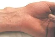 کشف رابطه بسیار عجیب مچ دست با زمان مرگ