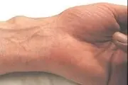 کشف رابطه بسیار عجیب مچ دست با زمان مرگ