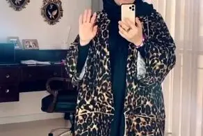  صبا راد با این عمل زیبایی مایکل جکسون ایران شد/ عکس عجیب