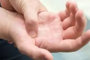 دست‌ها کلسترول بالای خون را نشان می‌دهند