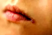 دلایل ترک گوشه‌های لب