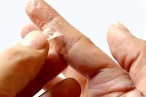 ترفند پاک کردن چسب قطره‌ای را از روی پوست‌