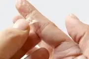 ترفند پاک کردن چسب قطره‌ای را از روی پوست‌