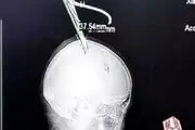 حرکت باورنکردنی یک زن با قیچی داخل سرش! + عکس