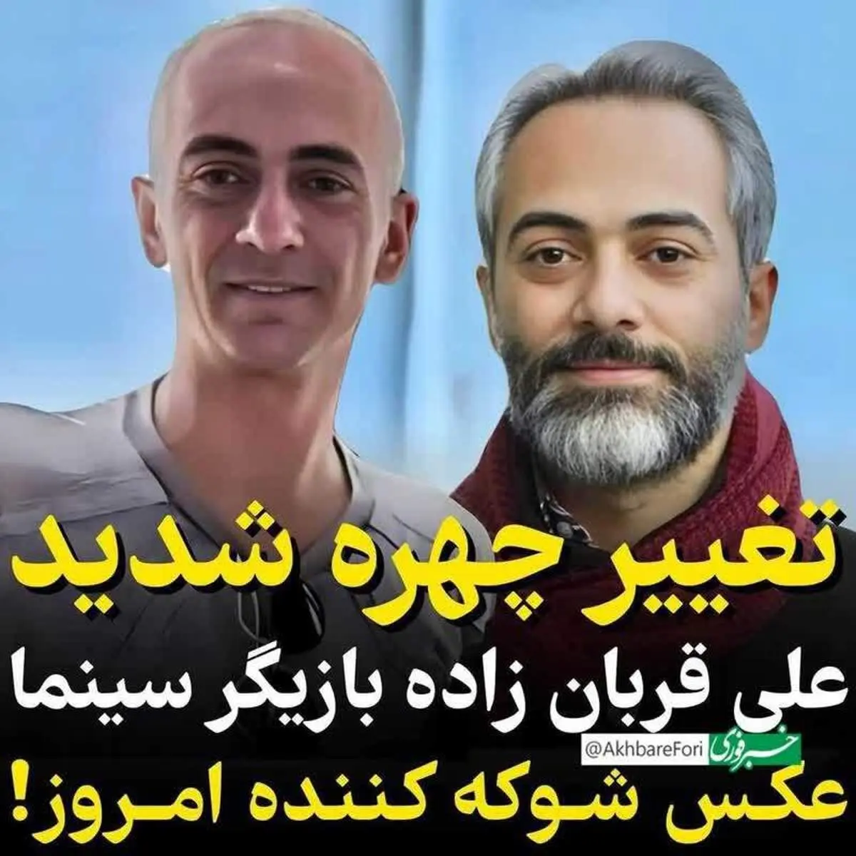 تصویر جدید از علی قربان زاده بازیگر ایرانی که همه رو شوکه کرد