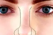 مردی که صاحب درازترین و بدفرم ترین بینی دنیا است+ عکس
