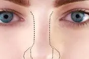 مردی که صاحب درازترین و بدفرم ترین بینی دنیا است+ عکس