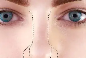 مردی که صاحب درازترین و بدفرم ترین بینی دنیا است+ عکس