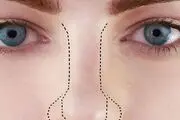 مردی که صاحب درازترین و بدفرم ترین بینی دنیا است+ عکس