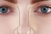 مردی که صاحب درازترین و بدفرم ترین بینی دنیا است+ عکس