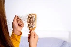 این خوراکی‌ها را نخورید تا کچل نشوید