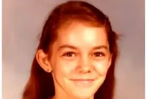 این دختر صاحب بزرگترین بینی  در دنیا است +عکس