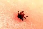افزایش تعداد مبتلایان به تب کریمه کنگو
