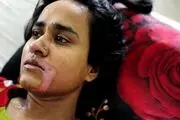 پدرشوهر وحشی در دهان عروسش اسید ریخت +عکس
