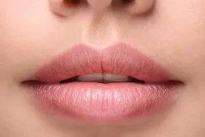 چگونه لب‌ها زیبا داشته باشیم!