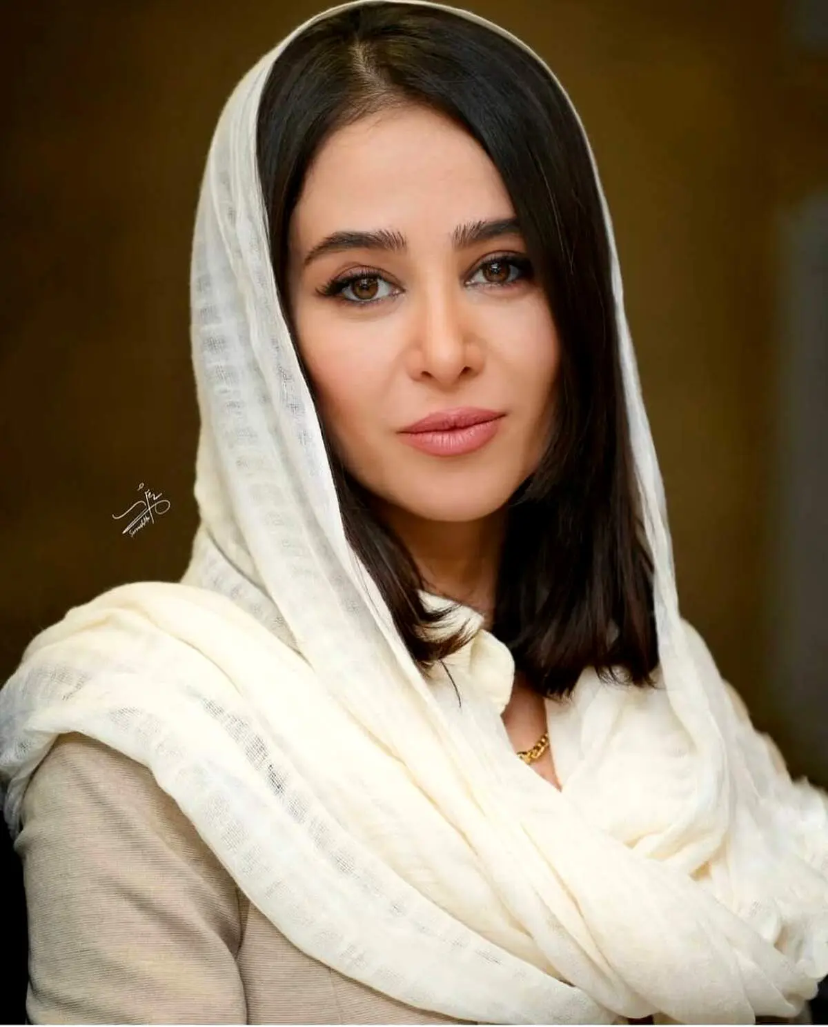 چهره واقعی الناز حبیبی قبل از جراحی‌های زیبایی!/عکس