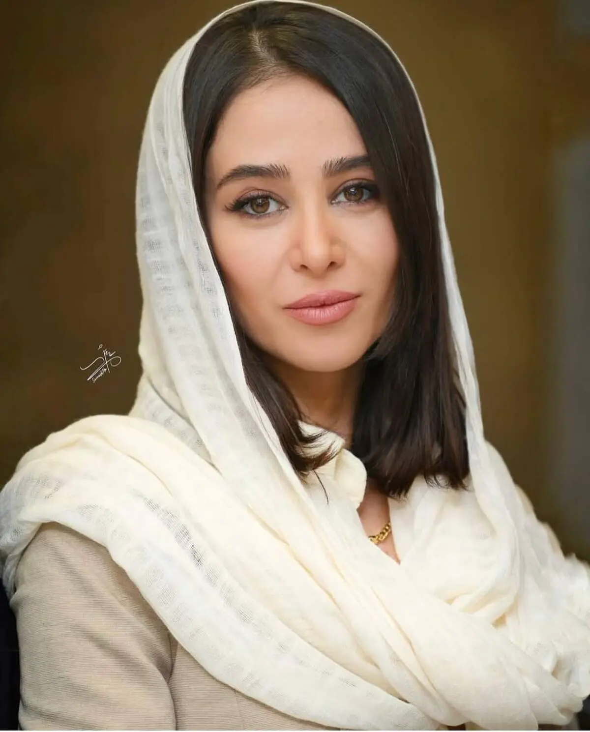 چهره واقعی الناز حبیبی قبل از جراحی‌های زیبایی!/عکس