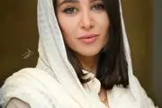 چهره واقعی الناز حبیبی قبل از جراحی‌های زیبایی!/عکس