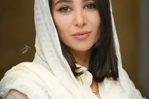 چهره واقعی الناز حبیبی قبل از جراحی‌های زیبایی!/عکس
