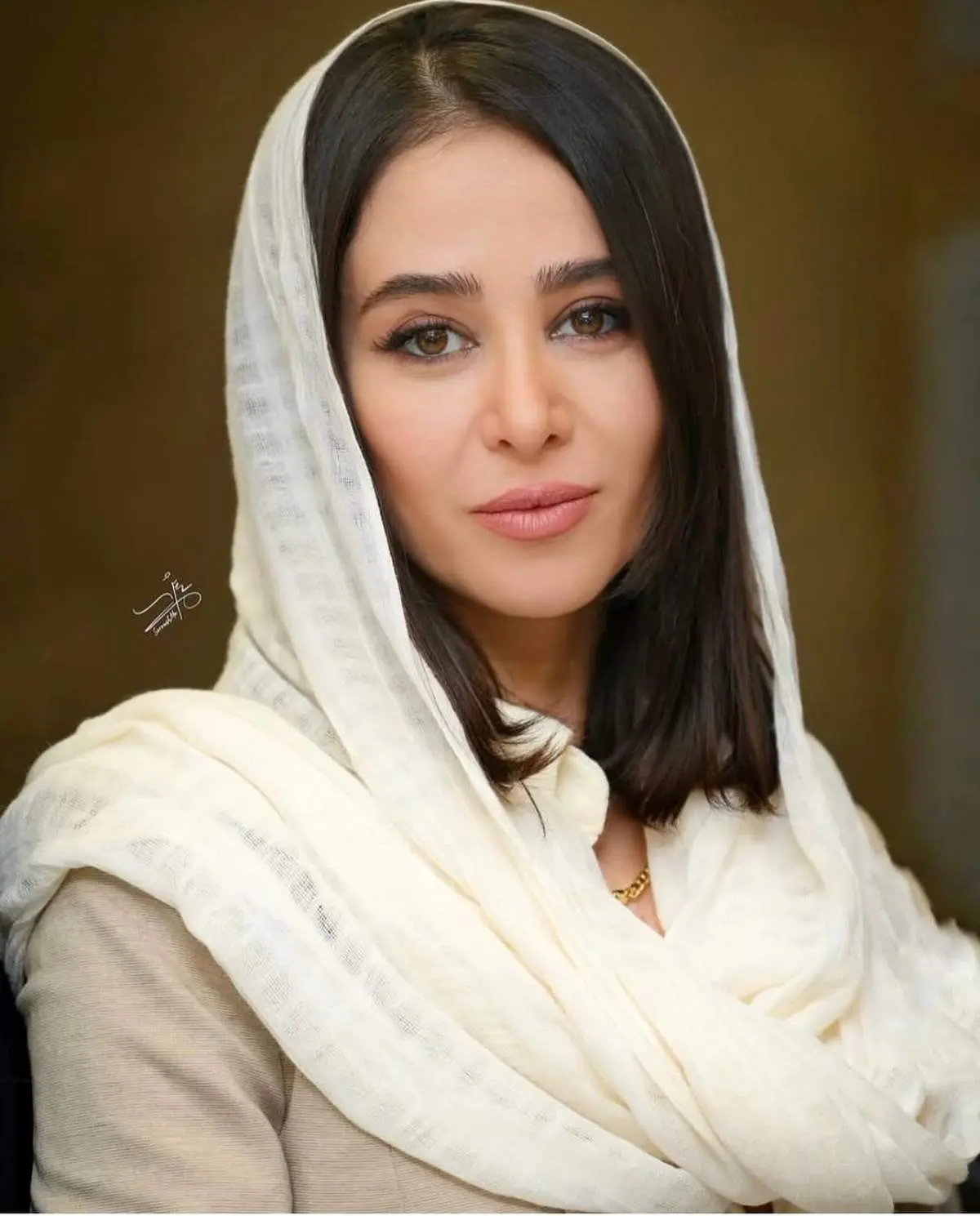 چهره واقعی الناز حبیبی قبل از جراحیهای زیبایی!/عکس