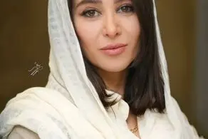 چهره واقعی الناز حبیبی قبل از جراحی‌های زیبایی!/عکس