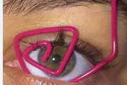 دختر ترسناک میمونی زیباترین دختر دنیا شد+ عکس